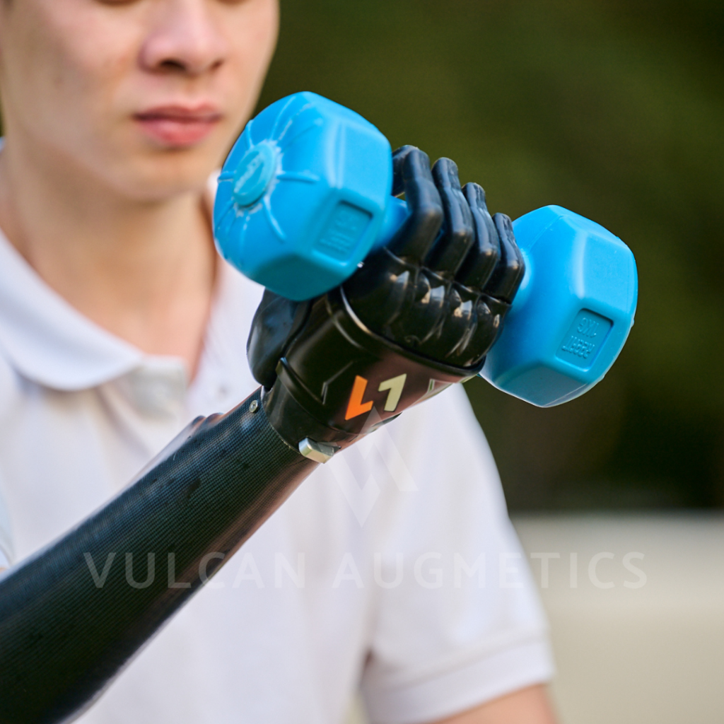 Một người đàn ông với cánh tay bị cắt cụt của mình đang đeo tay giả và cầm tạ trong công viên