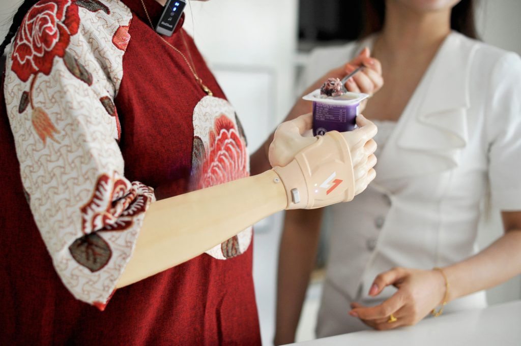 Một người phụ nữ mặc áo đỏ bị cắt cụt tay phải đang đeo tay giả điện chức năng Vulcan màu da sáng và cầm một hũ sữa chua