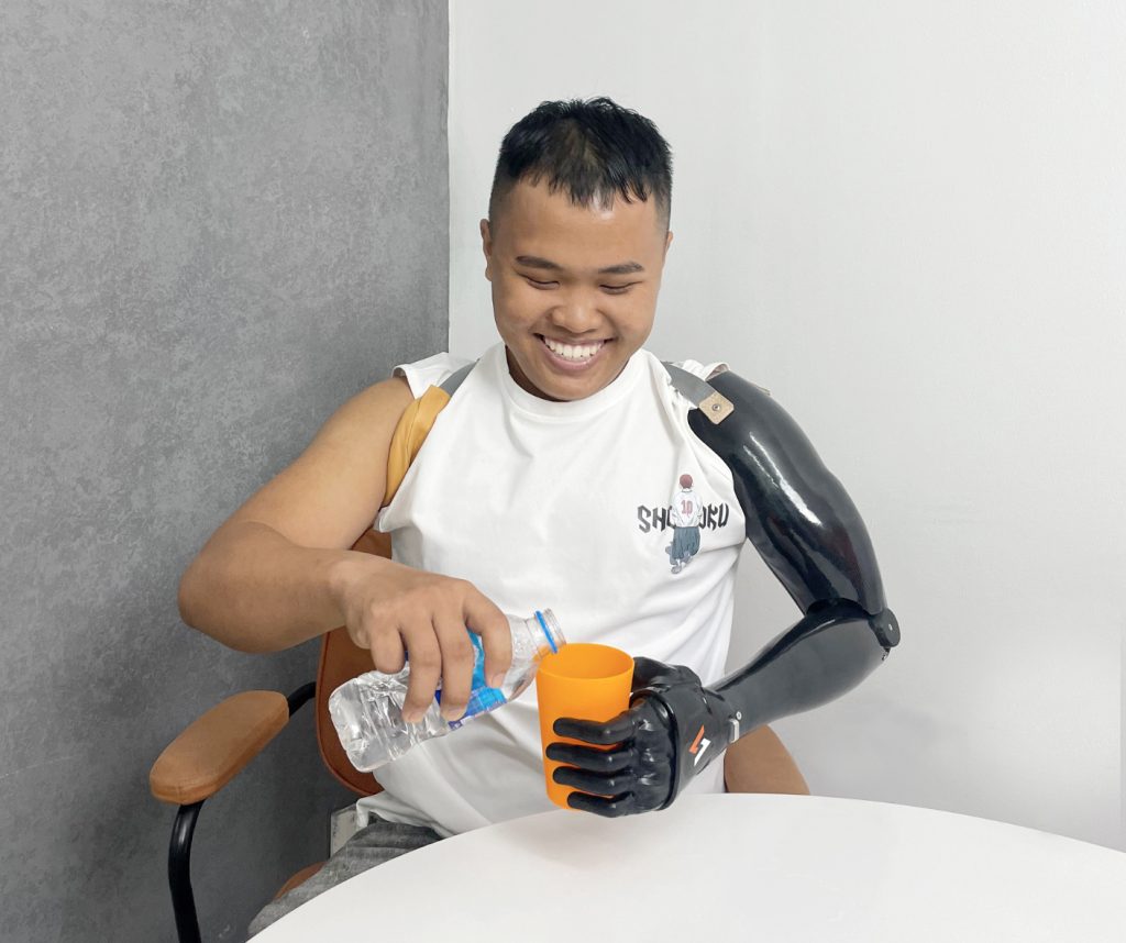 Một nam thanh niên đang mỉm cười rạng rỡ khi sử dụng tay giả điện chức năng Vulcan (dành cho người đoạn chi trên khuỷu, phiên bản màu đen) để giữ chặt một chiếc ly màu cam, trong khi tay còn lại đang tự rót nước từ chai nhựa vào ly.