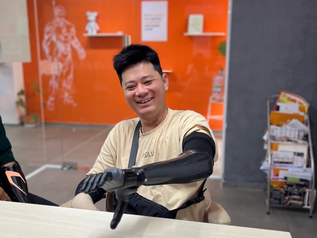 Doing Outdoor Activities with Your Vulcan Hand Prosthesis