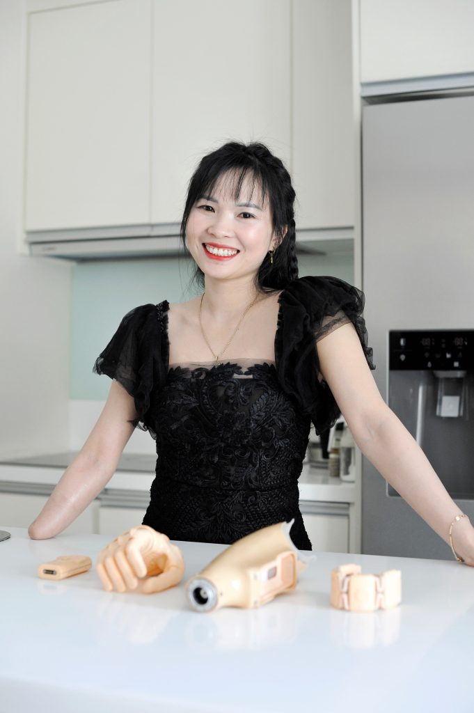 A smiling patient with a transradial amputation standing behind a counter with the modular components of her Vulcan myoelectric prosthesis, including the Vulcan hand, socket, and wireless EMG sensor band.