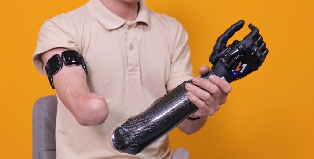 A person with a below-the-elbow amputation wearing the Vulcan Myoband—a black, segmented multi-sensor armband—on their upper arm. They are holding a sleek, carbon-fiber prosthetic hand (marked with the 'V1' logo) to demonstrate the connection between the sensors and the device against a bright yellow background.