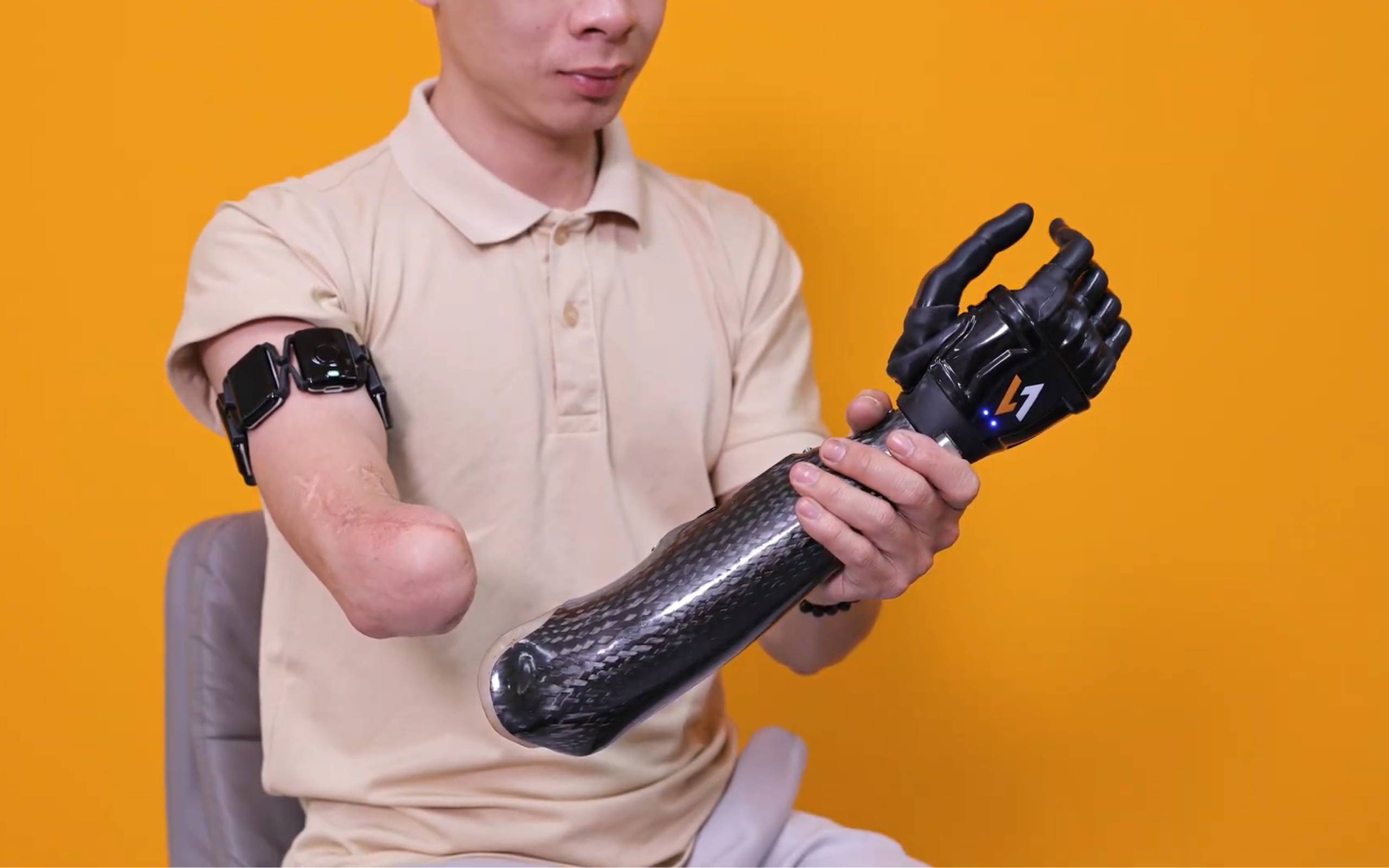 Vulcan Myoband sensor detecting muscle signals to control the Vulcan Myoelectric upper limb prosthetic hand