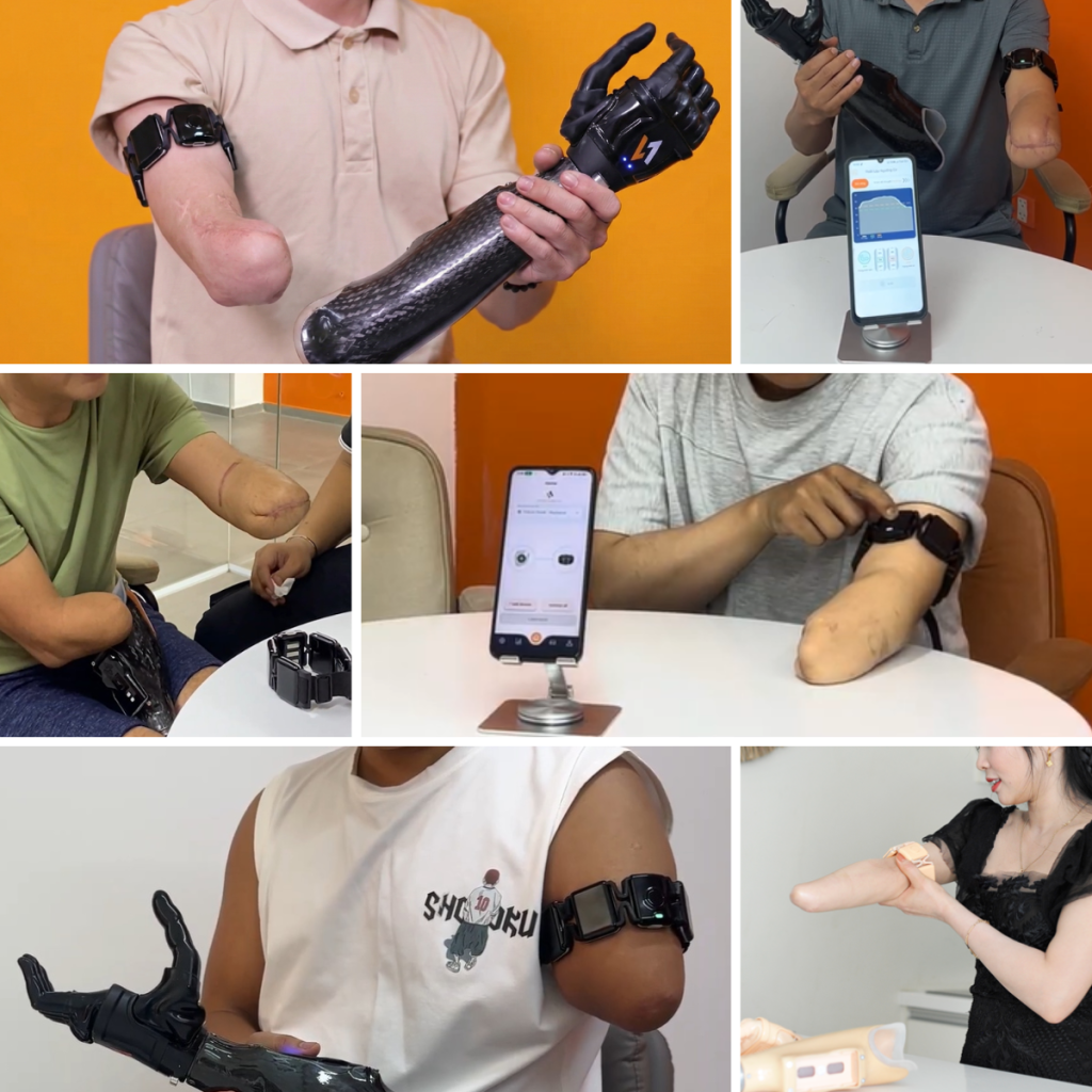 Vulcan Myoband multi-channel sEMG sensor array fitting workflow and real-time calibration app interface for upper-limb prosthetic patients.